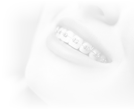 Conseils Cabinet d’orthodontie du Dr Matthieu Soto à Miramas