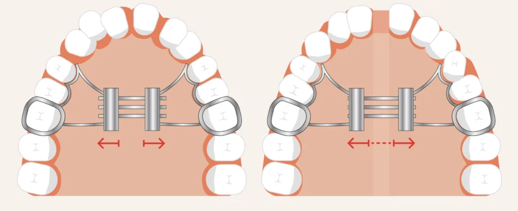 Comment activer son disjoncteur ? Cabinet dentaire du Dr Matthieu Soto à Miramas