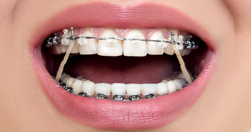 Incidents Cabinet d’orthodontie du Dr Matthieu Soto à Miramas